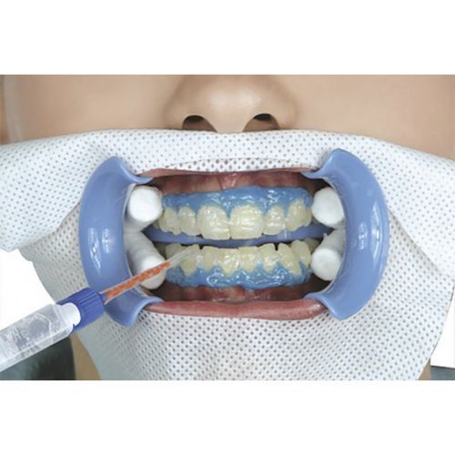 Гель отбеливающий Dual-Barrel Syringe of Beyond II Whitening Gel (4 г)