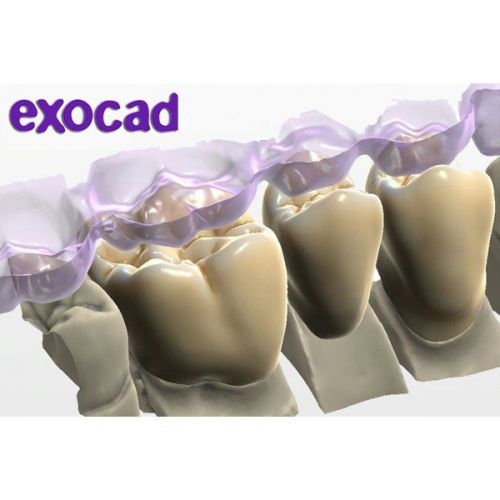 ExoCad - многофункциональное программное обеспечение для CAD-стоматологии — дополнительное фото