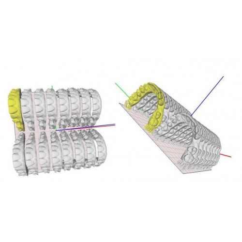 Basic (Dental) - профессиональный 3D-принтер для стоматологии — дополнительное фото