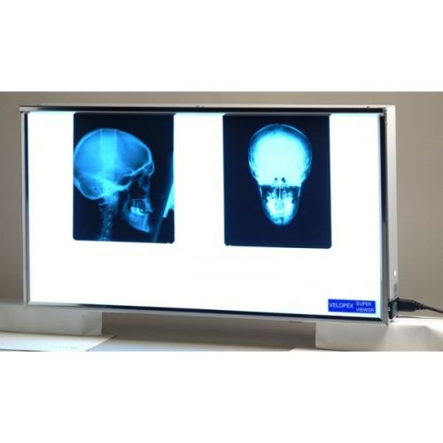 Velopex Super Viewer - универсальный негатоскоп для всех типов рентгенограмм — дополнительное фото