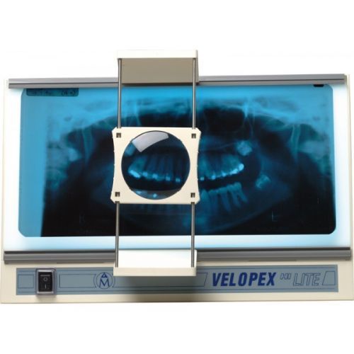 Velopex Hi Lite Viewer - стоматологический негатоскоп для интраоральных и панорамных рентгенограмм, с лупой — дополнительное фото
