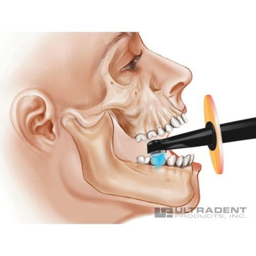 VALO Cordless - беспроводная светодиодная фотополимеризационная лампа c тремя режимами полимеризации — дополнительное фото